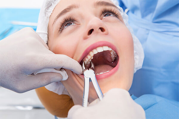 tooth extraction at-Good-Samaritan-Dental-Implant-Institute