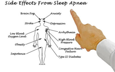 Obstructive Sleep Apnea: Understanding the Causes, Symptoms, and Treatment