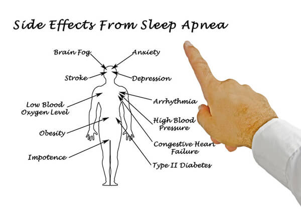obstructive-sleep-apnea-good-samaritan