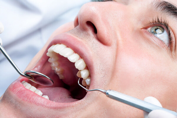 teeth-whitener-oral-health-good-samaritan
