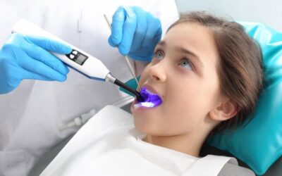 Everything You Need to Know About Dental Sealants