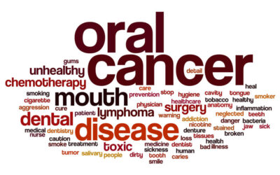 Oral Cancer: What You Need To Know To Stay Healthy