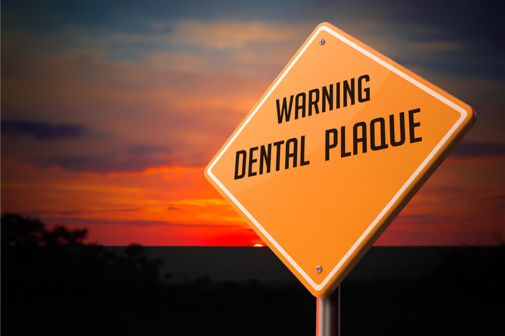 Properly Managing Plaque and the Problems It Creates