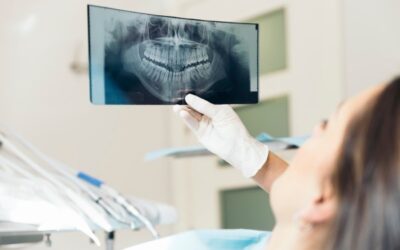 What You Should Expect From Oral Maxillofacial Surgery