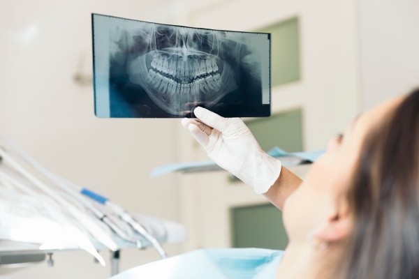 What You Should Expect From Oral Maxillofacial Surgery