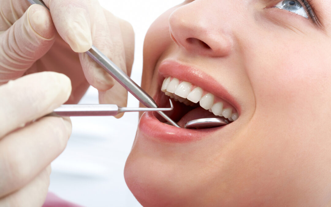 Understanding Your Options When Dental Fillings Need Replacing 