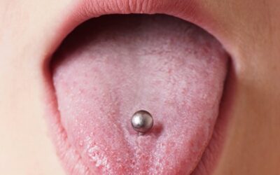 Oral Piercing: Its Effect on Oral Health