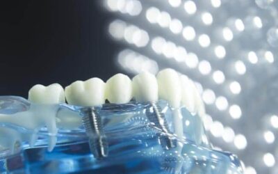 Why The Straumann Dental Implant System Is Superior To All Others
