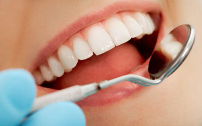 How Do Dental Implants Benefit Oral Health