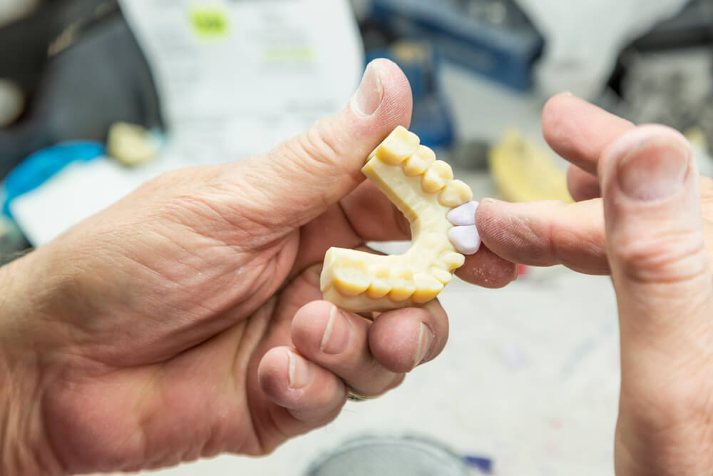 how-3d-printing-is-used-in-the-dental-implant-industry-local-view-digital-marketing