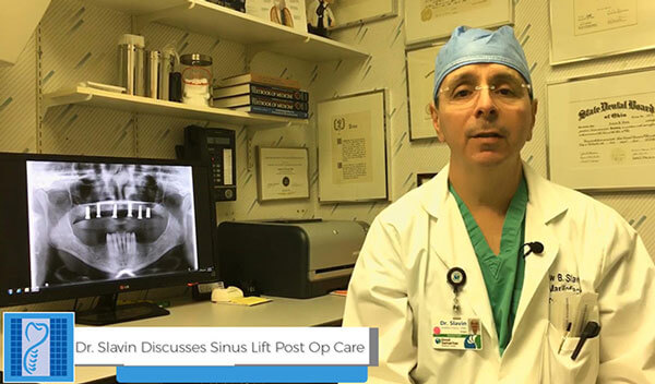 Sinus-Lift-Post-Operative-Care-good-Samaritan-Dental-Implant
